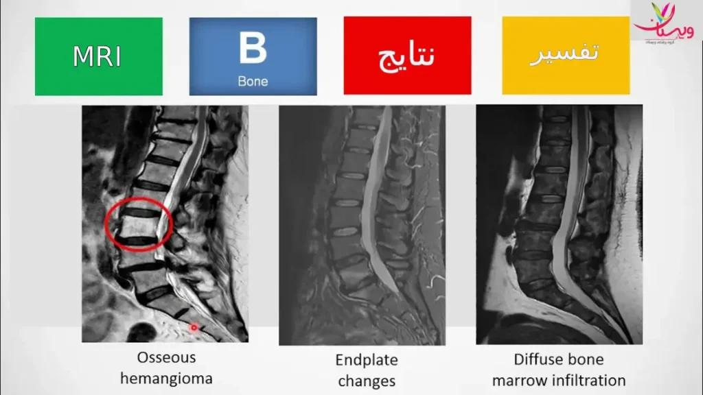 تفسیر نتایج MRI به زبان ساده