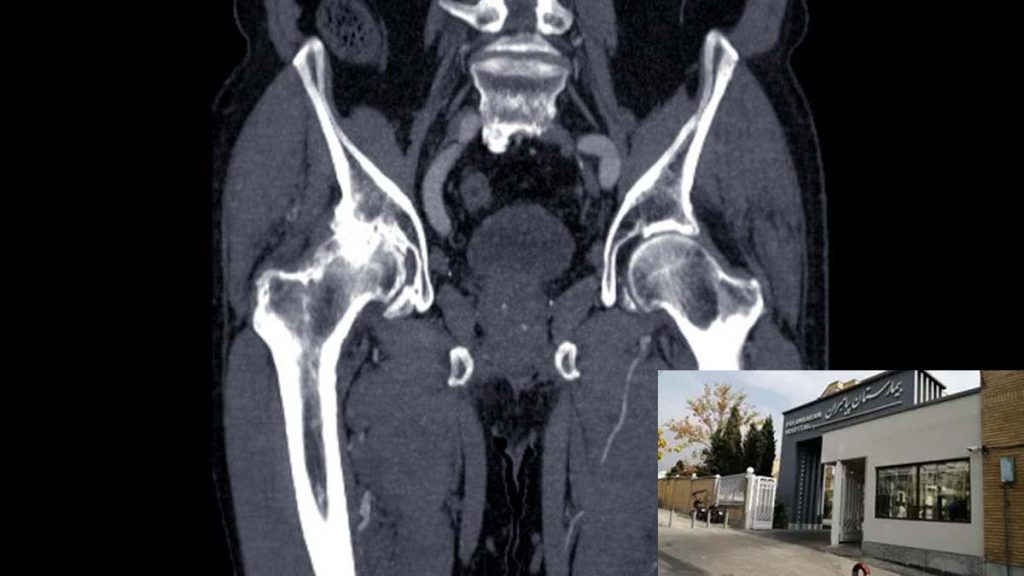 شماره تلفن سی تی بیمارستان پیامبران شماره تلفن سی تی انژیوگرافی بیمارستان پیامبران